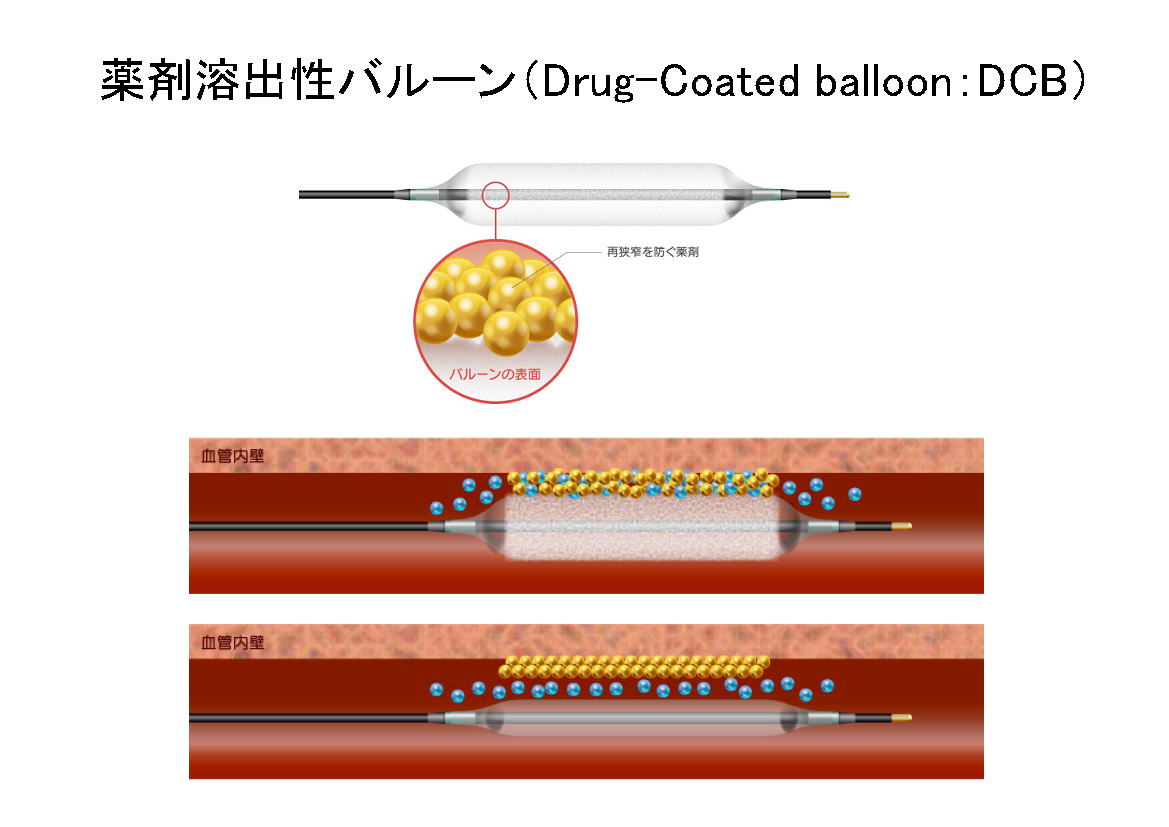 循環器の写真2.png