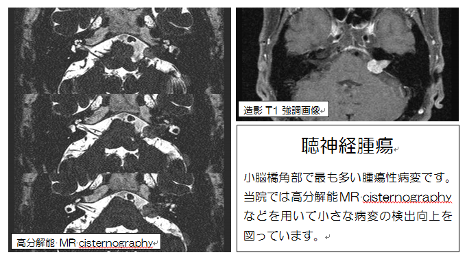 見える診える栗中のMRI　その１