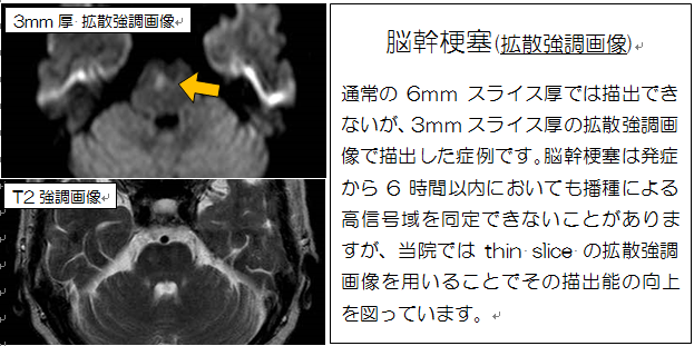 見える診える栗中のMRI　その２