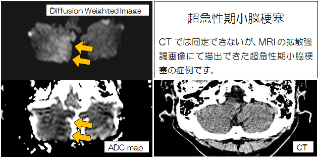 見える診える栗中のMRI　その３