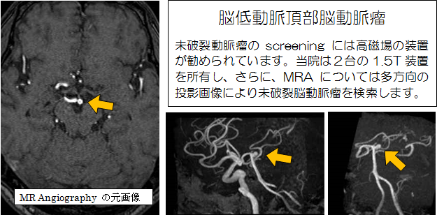 見える診える栗中のMRI　その4