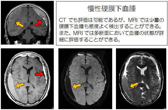 見える診える栗中のMRI　その5